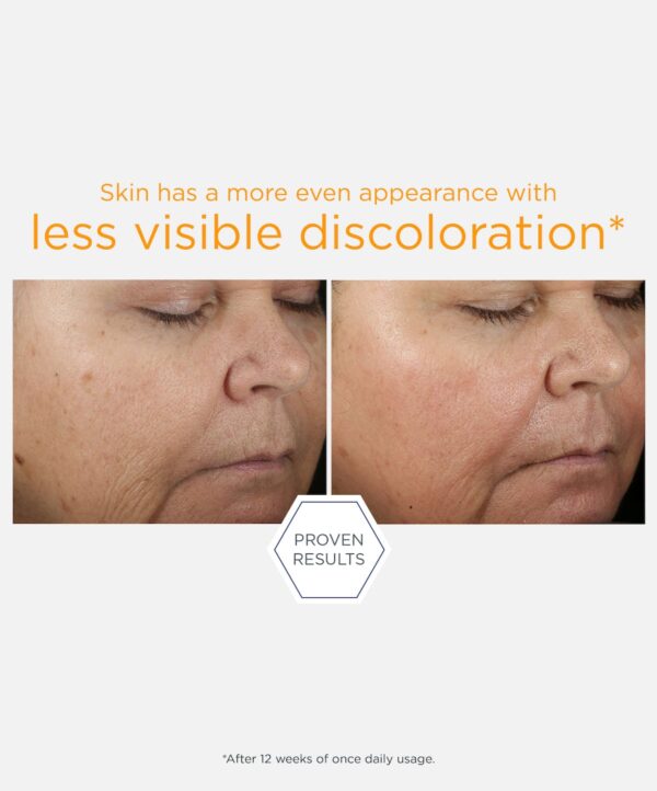 15% Vitamin C + PHA Serum - Bild 4