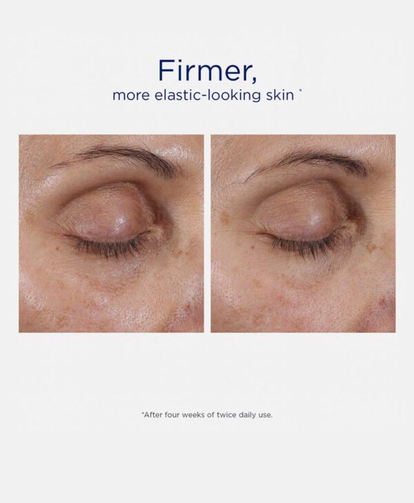 Intensive Eye Therapy - Bild 5