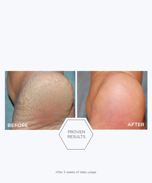 Problem Dry Skin Cream - Bild 4