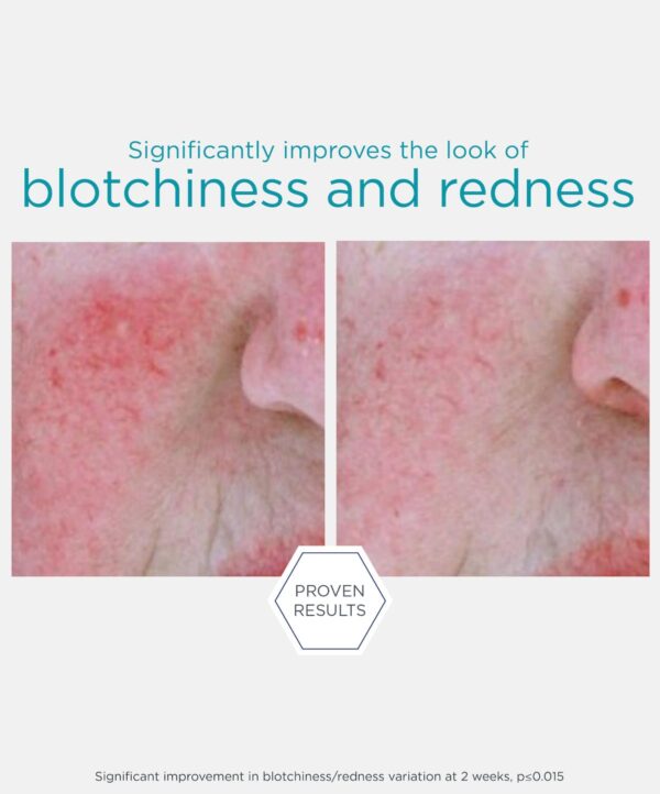 Redness Neutralizing Serum - Bild 4